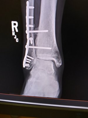 20181130_133749_HDR.jpg 20181130_133749_HDR.jpg