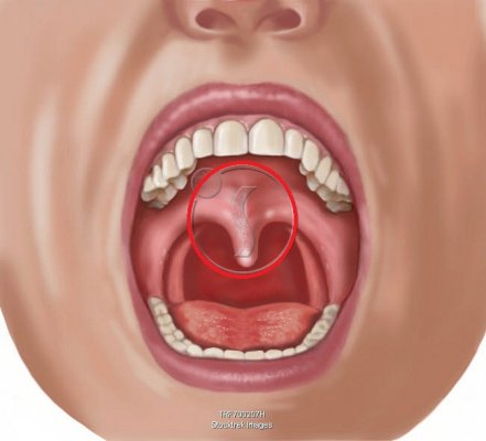 trf700207h-Looking-into-open-mouth-showing-uvula-teeth-tongue.jpg trf700207h-Looking-into-open-mouth-showing-uvula-teeth-tongue.jpg